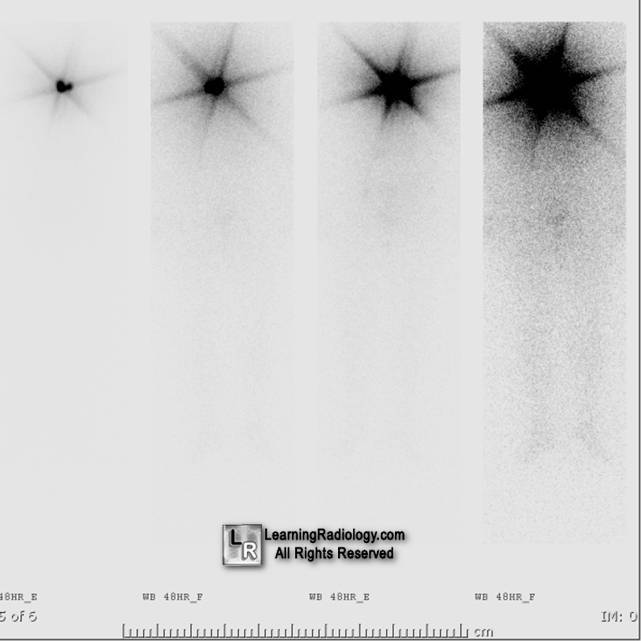 six point star sign-nucs